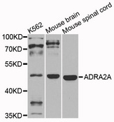 ADRA2A Antibody - Western blot analysis of extracts of various cells.
