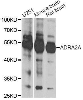 ADRA2A Antibody - Western blot analysis of extracts of various cell lines, using ADRA2A antibody at 1:1000 dilution. The secondary antibody used was an HRP Goat Anti-Rabbit IgG (H+L) at 1:10000 dilution. Lysates were loaded 25ug per lane and 3% nonfat dry milk in TBST was used for blocking. An ECL Kit was used for detection and the exposure time was 20s.