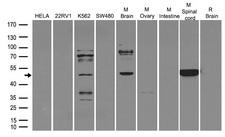 ADRA2A Antibody - Western blot analysis of extracts. (35ug) from different cell lines or tissues by using anti-ADRA2A rabbit polyclonal antibody .