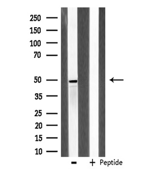 ADRA2A Antibody - Western blot analysis of extracts of LOVO cells using Adrenergic Receptor a-2A antibody.