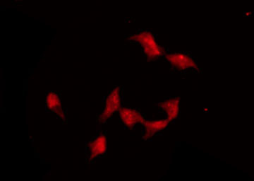 ADRA2A Antibody - Staining HeLa cells by IF/ICC. The samples were fixed with PFA and permeabilized in 0.1% Triton X-100, then blocked in 10% serum for 45 min at 25°C. The primary antibody was diluted at 1:200 and incubated with the sample for 1 hour at 37°C. An Alexa Fluor 594 conjugated goat anti-rabbit IgG (H+L) Ab, diluted at 1/600, was used as the secondary antibody.