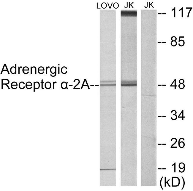 ADRA2A Antibody - Western blot analysis of extracts from LOVO cells and Jurkat cells, using Adrenergic Receptor a-2A antibody.