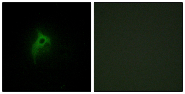 ADRA2B Antibody - Immunofluorescence analysis of HepG2 cells, using Adrenergic Receptor alpha-2B Antibody. The picture on the right is blocked with the synthesized peptide.