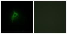 ADRA2B Antibody - Immunofluorescence analysis of HepG2 cells, using Adrenergic Receptor alpha-2B Antibody. The picture on the right is blocked with the synthesized peptide.