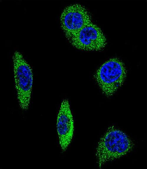 ADRA2B Antibody - Confocal immunofluorescence of ADRA2B Antibody with MDA-MB231 cell followed by Alexa Fluor 488-conjugated goat anti-rabbit lgG (green). DAPI was used to stain the cell nuclear (blue).