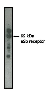 ADRA2B Antibody - Western blot of alpha2B adrenergic receptor antibody on MDCK cells transfected to produce alpha2B receptor protein.