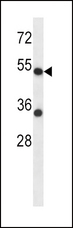 ADRA2C Antibody - ADRA2C Antibody western blot of HepG2 cell line lysates (35 ug/lane). The ADRA2C antibody detected the ADRA2C protein (arrow).