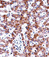 ADRA2C Antibody - ADRA2C Antibody immunohistochemistry of formalin-fixed and paraffin-embedded human liver tissue followed by peroxidase-conjugated secondary antibody and DAB staining.