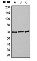 ADRA2C Antibody - Western blot analysis of Alpha-2C Adrenergic Receptor expression in Jurkat (A); mouse liver (B); rat liver (C) whole cell lysates.