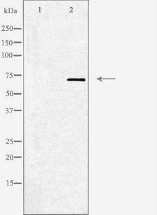 ADRA2C Antibody - Western blot analysis of extracts of HepG2 cells using Adrenergic Receptor a-2C antibody. The lane on the left is treated with the antigen-specific peptide.