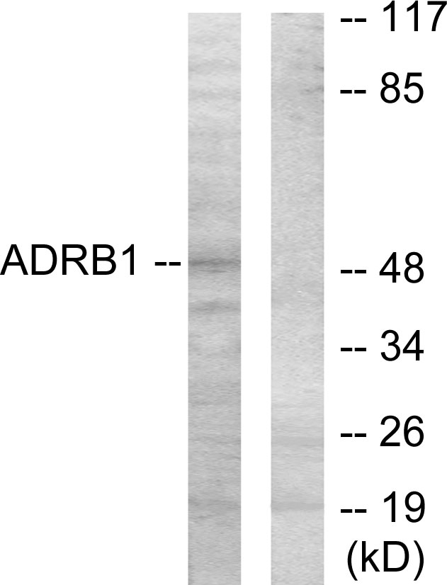 ADRB1 Antibody - Western blot analysis of lysates from HT-29 cells, using ADRB1 Antibody. The lane on the right is blocked with the synthesized peptide.