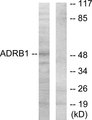 ADRB1 Antibody - Western blot analysis of lysates from HT-29 cells, using ADRB1 Antibody. The lane on the right is blocked with the synthesized peptide.