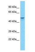 ADRB1 Antibody - ADRB1 antibody Western Blot of THP-1. Antibody dilution: 3 ug/ml.  This image was taken for the unconjugated form of this product. Other forms have not been tested.