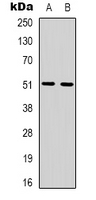ADRB1 Antibody - Western blot analysis of Beta-1 Adrenergic Receptor expression in HepG2 (A); A431 (B) whole cell lysates.