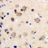 ADRB1 Antibody - Immunohistochemical analysis of Beta-1 Adrenergic Receptor staining in human brain formalin fixed paraffin embedded tissue section. The section was pre-treated using heat mediated antigen retrieval with sodium citrate buffer (pH 6.0). The section was then incubated with the antibody at room temperature and detected with HRP and DAB as chromogen. The section was then counterstained with hematoxylin and mounted with DPX.