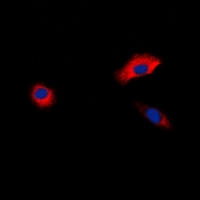 ADRB1 Antibody - Immunofluorescent analysis of Beta-1 Adrenergic Receptor staining in HepG2 cells. Formalin-fixed cells were permeabilized with 0.1% Triton X-100 in TBS for 5-10 minutes and blocked with 3% BSA-PBS for 30 minutes at room temperature. Cells were probed with the primary antibody in 3% BSA-PBS and incubated overnight at 4 deg C in a humidified chamber. Cells were washed with PBST and incubated with a DyLight 594-conjugated secondary antibody (red) in PBS at room temperature in the dark. DAPI was used to stain the cell nuclei (blue).