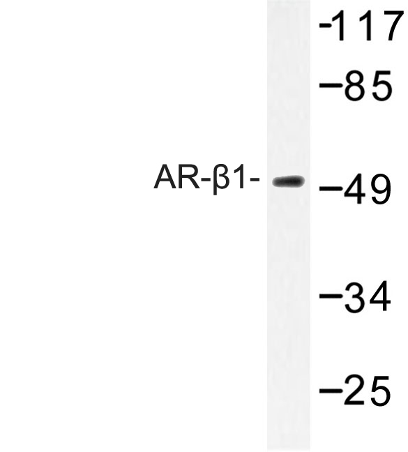 ADRB1 Antibody - Western blot of AR-1 (A302) pAb in extracts from HT-29 cells.