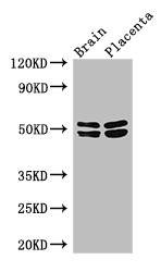 ADRB1 Antibody - Positive WB detected in:Mouse brain tissue,Human placenta tissue;All lanes: ADRB1 antibody at 3ug/ml;Secondary;Goat polyclonal to rabbit IgG at 1/50000 dilution;Predicted band size: 52 kDa;Observed band size: 52,48 kDa;