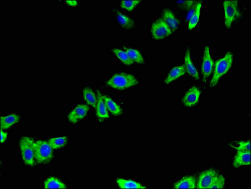 ADRB1 Antibody - Immunofluorescent analysis of HepG2 cells using ADRB1 Antibody at a dilution of 1:100 and Alexa Fluor 488-congugated AffiniPure Goat Anti-Rabbit IgG(H+L)