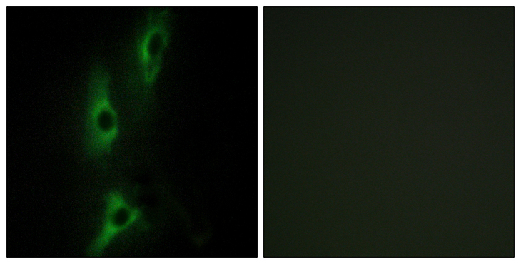 ADRB2 Antibody - Immunofluorescence analysis of NIH/3T3 cells, using ADRB2 Antibody. The picture on the right is blocked with the synthesized peptide.