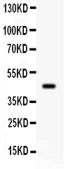 ADRB2 Antibody - ADRB2 antibody Western blot. All lanes: AntiADRB2 at 0.5 ug/ml. WB: Rat Brain Tissue Lysate at 50 ug. Predicted band size: 47 kD. Observed band size: 47 kD.