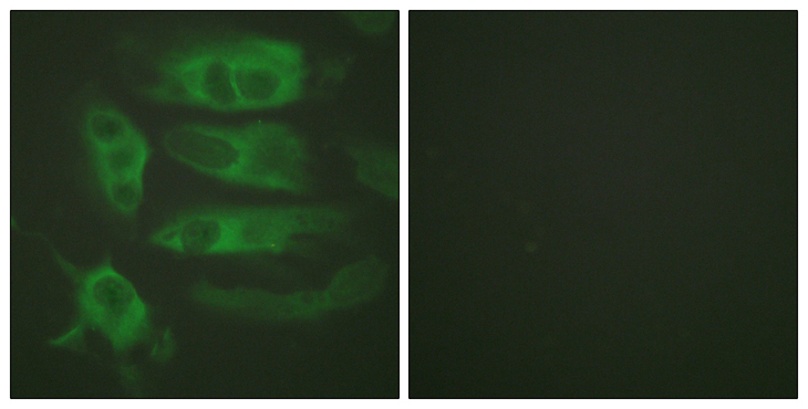 ADRB2 Antibody - Immunofluorescence analysis of HeLa cells, using Adrenergic Receptor beta2 Antibody. The picture on the right is blocked with the synthesized peptide.