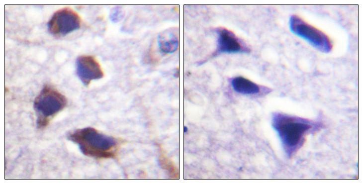 ADRB2 Antibody - Immunohistochemistry analysis of paraffin-embedded human brain tissue, using Adrenergic Receptor beta2 Antibody. The picture on the right is blocked with the synthesized peptide.