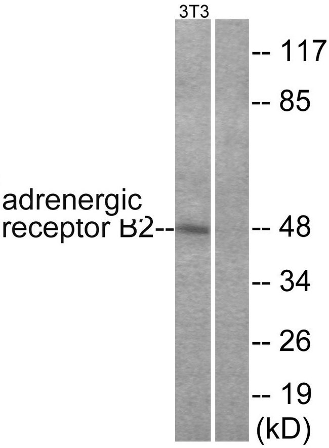 ADRB2 Antibody - Western blot analysis of lysates from NIH/3T3 cells, using Adrenergic Receptor beta2 Antibody. The lane on the right is blocked with the synthesized peptide.