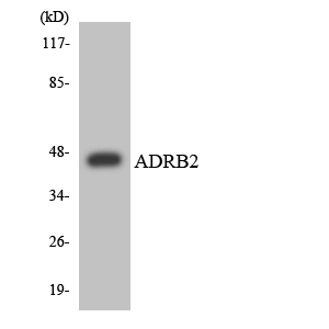 ADRB2 Antibody - Western blot analysis of the lysates from HUVECcells using ADRB2 antibody.