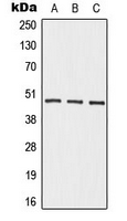 ADRB2 Antibody - Western blot analysis of Beta-2 Adrenergic Receptor expression in HepG2 (A); mouse kidney (B); rat kidney (C) whole cell lysates.