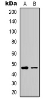 ADRB2 Antibody - Western blot analysis of Beta-2 Adrenergic Receptor expression in HeLa (A); HepG2 (B) whole cell lysates.
