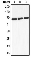 ADRB2 Antibody - Western blot analysis of Beta-2 Adrenergic Receptor expression in HEK293T (A); mouse liver (B); rat kidney (C) whole cell lysates.