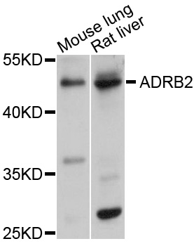 ADRB2 Antibody - Western blot analysis of extracts of various cell lines.