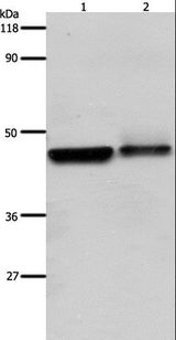 ADRB2 Antibody - Western blot analysis of HeLa and A549 cell, using ADRB2 Polyclonal Antibody at dilution of 1:600.