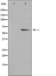 ADRB2 Antibody - Western blot analysis of extracts of HeLa cells using ADRB2 antibody. The lane on the left is treated with the antigen-specific peptide.