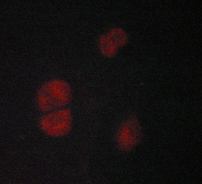 ADRB2 Antibody - Staining MCF-7 cells by IF/ICC. The samples were fixed with PFA and permeabilized in 0.1% saponin prior to blocking in 10% serum for 45 min at 37°C. The primary antibody was diluted 1/400 and incubated with the sample for 1 hour at 37°C. A Alexa Fluor® 594 conjugated goat polyclonal to rabbit IgG (H+L), diluted 1/600 was used as secondary antibody.