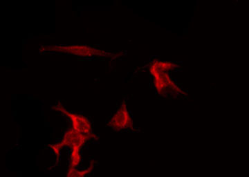 ADRB2 Antibody - Staining HuvEc cells by IF/ICC. The samples were fixed with PFA and permeabilized in 0.1% Triton X-100, then blocked in 10% serum for 45 min at 25°C. The primary antibody was diluted at 1:200 and incubated with the sample for 1 hour at 37°C. An Alexa Fluor 594 conjugated goat anti-rabbit IgG (H+L) Ab, diluted at 1/600, was used as the secondary antibody.