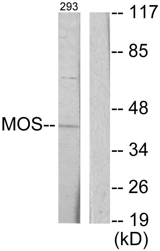 ADRB2 Antibody - Western blot analysis of extracts from 293 cells, using MOS antibody.