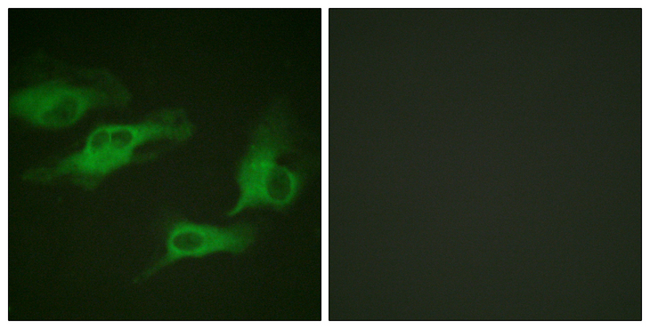 ADRB2 Antibody - Immunofluorescence analysis of HeLa cells, using Adrenergic Receptor beta2 (Phospho-Ser346) Antibody. The picture on the right is blocked with the phospho peptide.