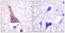 ADRB2 Antibody - Immunohistochemistry analysis of paraffin-embedded human brain, using Adrenergic Receptor beta2 (Phospho-Ser346) Antibody. The picture on the right is blocked with the phospho peptide.