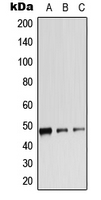 ADRB2 Antibody - Western blot analysis of Beta-2 Adrenergic Receptor (pS346) expression in HepG2 PMA-treated (A); mouse spleen (B); rat spleen (C) whole cell lysates.