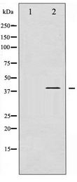 ADRB2 Antibody - Western blot of Adrenergic Receptor beta2 phosphorylation expression in nocodazole treated HepG2 whole cell lysates,The lane on the left is treated with the antigen-specific peptide.