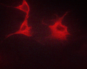 ADRB2 Antibody - Staining HeLa cells by IF/ICC. The samples were fixed with PFA and permeabilized in 0.1% saponin prior to blocking in 10% serum for 45 min at 37°C. The primary antibody was diluted 1/400 and incubated with the sample for 1 hour at 37°C. A Alexa Fluor® 594 conjugated goat polyclonal to rabbit IgG (H+L), diluted 1/600 was used as secondary antibody.