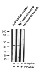 ADRB2 Antibody - Western blot analysis of Adrenergic Receptor beta2 phosphorylation expression in nocodazole treated HepG2 whole cells lysates
