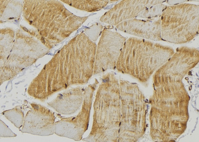 ADRB2 Antibody - 1:100 staining mouse muscle tissue by IHC-P. The sample was formaldehyde fixed and a heat mediated antigen retrieval step in citrate buffer was performed. The sample was then blocked and incubated with the antibody for 1.5 hours at 22°C. An HRP conjugated goat anti-rabbit antibody was used as the secondary.