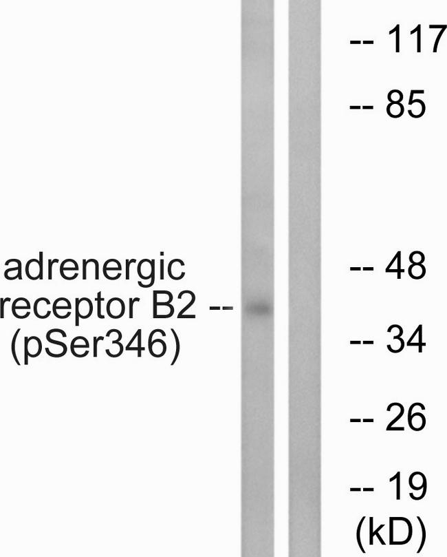 ADRB2 Antibody - Western blot analysis of extracts from HepG2 cells, treated with nocodazole (1ug/ml, 16hours), using Adrenergic Receptor ß2 (Phospho-Ser346) antibody.