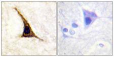 ADRB2 Antibody - Immunohistochemistry analysis of paraffin-embedded human brain, using Adrenergic Receptor B2 (Phospho-Ser355+Ser356) Antibody. The picture on the right is blocked with the phospho peptide.