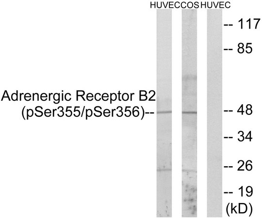 ADRB2 Antibody - Western blot analysis of lysates from HUVEC cells treated with serum 20% 15' and COS7 cells treated with serum 20% 15', using Adrenergic Receptor B2 (Phospho-Ser355+Ser356) Antibody. The lane on the right is blocked with the phospho peptide.