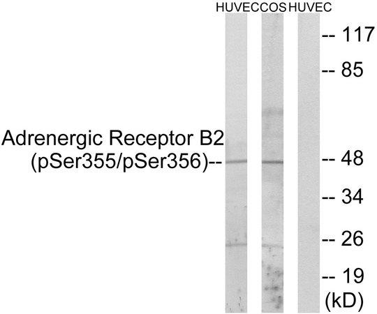 ADRB2 Antibody - Western blot analysis of extracts from HUVEC cells and COS cells treated with serum (20%, 15mins), using Adrenergic Receptor B2 (Phospho-Ser355+Ser356) antibody.