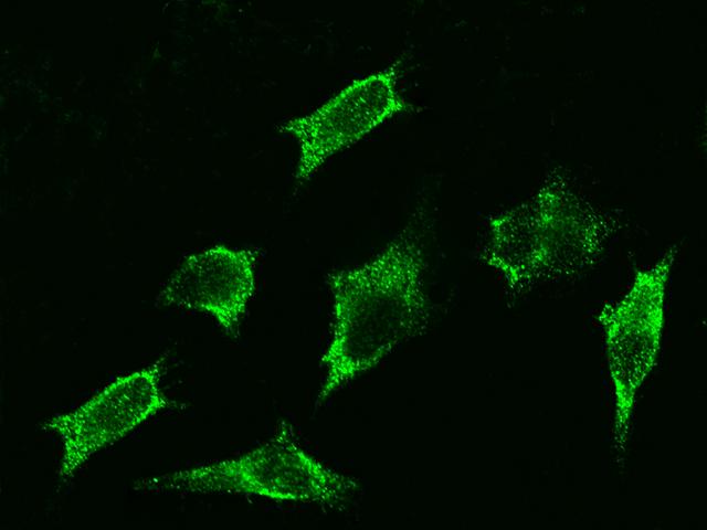 ADRB2 Antibody - Immunofluorescence staining of ADRB2 in HeLa cells. Cells were fixed with 4% PFA, blocked with 10% serum, and incubated with rabbit anti-human ADRB2 polyclonal antibody (dilution ratio 1:1000) at 4°C overnight. Then cells were stained with the Alexa Fluor 488-conjugated Goat Anti-rabbit IgG secondary antibody (green). Positive staining was localized to cytoplasm.